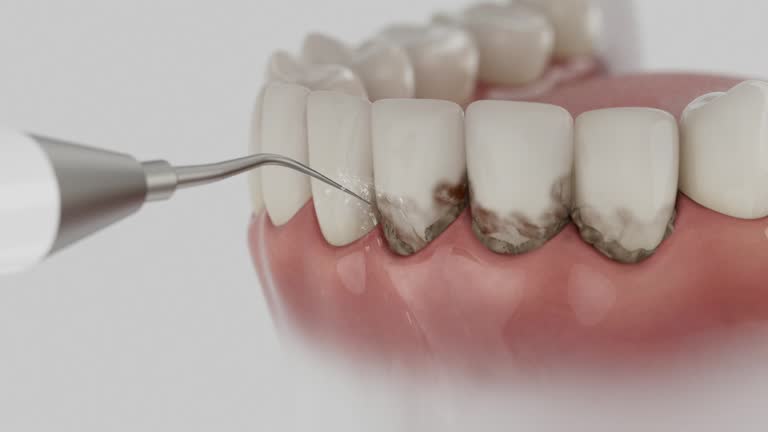 Trusted Root Canal Treatment service in Lovell, WY - Dentist Open Now
